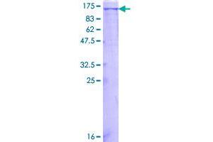 Image no. 1 for Mast/stem Cell Growth Factor Receptor (KIT) (AA 1-976) protein (GST tag) (ABIN1308713)