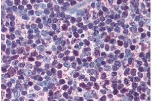Human Thymus (formalin-fixed, paraffin-embedded) stained with CASP3 antibody ABIN305732 at 5 ug/ml followed by biotinylated anti-mouse IgG secondary antibody ABIN481714, alkaline phosphatase-streptavidin and chromogen. (Caspase 3 anticorps)