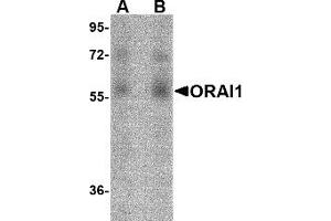 Western Blotting (WB) image for anti-ORAI Calcium Release-Activated Calcium Modulator 1 (ORAI1) antibody (ABIN1031711) (ORAI1 anticorps)