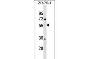 ENTPD5 Antibody (C-term) (ABIN1537153 and ABIN2838297) western blot analysis in ZR-75-1 cell line lysates (35 μg/lane). (ENTPD5 anticorps  (C-Term))