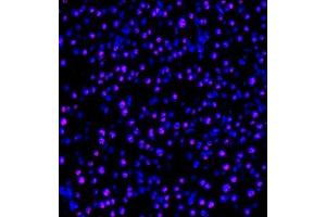 Immunofluorescence of paraffin embedded mouse pancreas using PP4R2 (ABIN7075284) at dilution of 1:1000 (400x lens) (PPP4R2 anticorps)