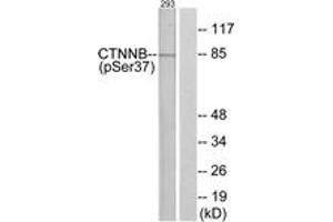 Western blot analysis of extracts from 293 cells, using Catenin-beta (Phospho-Ser37) Antibody. (beta Catenin anticorps  (pSer37))