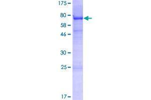 Image no. 1 for V-Set and Immunoglobulin Domain Containing 1 (VSIG1) (AA 1-387) protein (GST tag) (ABIN1325120)