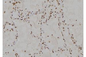 ABIN6275651 at 1/100 staining Human  tissue by IHC-P. (USP13 anticorps  (C-Term))