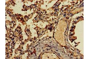 Immunohistochemistry of paraffin-embedded human lung tissue using ABIN7145950 at dilution of 1:100