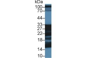 Western Blot; Sample: Porcine Cerebrum lysate; Primary Ab: 1µg/ml Rabbit Anti-Human SNAP25 Antibody Second Ab: 0. (SHISA4 anticorps  (AA 28-197))