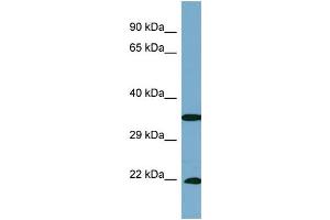 Host:  Rabbit  Target Name:  SLC6A6  Sample Type:  PANC1 Whole cell lysates  Antibody Dilution:  1. (TAUT anticorps  (C-Term))