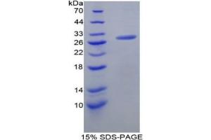 SDS-PAGE of Protein Standard from the Kit (Highly purified E.