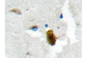 Immunohistochemistry analyzes of MgcRacGAP antibody in paraffin-embedded human brain tissue. (RACGAP1 anticorps)