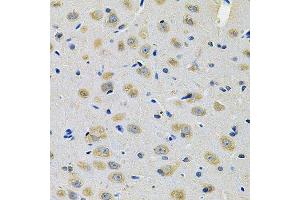 Immunohistochemistry of paraffin-embedded rat brain using TXNDC5 Antibody.
