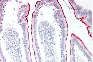 ABIN185111 (5µg/ml) staining of paraffin embedded Human Small Intestine. (VPS45 anticorps  (C-Term))