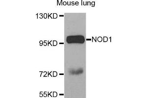 Western blot analysis of extracts of Mouse lung tissue, using NOD1 antibody. (NOD1 anticorps)