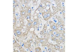 Immunohistochemistry of paraffin-embedded Human liver using R Rabbit pAb (ABIN6131585, ABIN6146704, ABIN6146705 and ABIN6222716) at dilution of 1:50 (40x lens). (Chemerin anticorps  (AA 17-163))