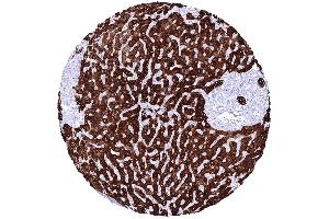 Liver In the liver a strong cytoplasmic staining of all bile ductal epithelial cells and an at least moderate predominantly membranous immunostaining of hepatocytes is seen