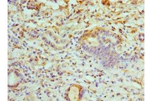 Immunohistochemistry of paraffin-embedded human kidney tissue using ABIN7175230 at dilution of 1:100 (ATP6V1B1 anticorps  (AA 1-280))