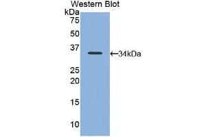 Detection of Recombinant NB1, Mouse using Polyclonal Antibody to Neutrophil Specific Antigen 1 (NB1) (CD177 anticorps  (AA 193-468))