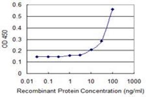 anti-Diphthamide Biosynthesis Protein 2 (DPH2) (AA 1-489) antibody