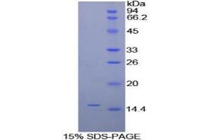 SDS-PAGE analysis of Human alpha Galactosidase Protein. (GLA Protéine)