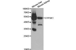 Western blot analysis of extracts of various cell lines, using CYP2E1 antibody. (CYP2E1 anticorps  (AA 234-493))