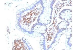 Formalin-fixed, paraffin-embedded human Colon stained with MAPK14 Mouse Monoclonal Antibody (CPTC-MAPK14-1). (MAPK14 anticorps)