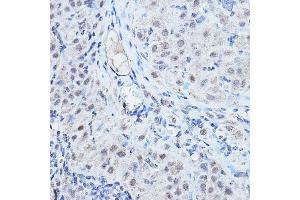 Immunohistochemistry of paraffin-embedded rat ovary using DGCR8 Rabbit pAb (ABIN7266761) at dilution of 1:200 (40x lens).
