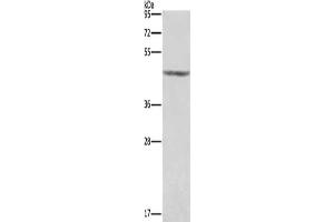 Gel: 8 % SDS-PAGE, Lysate: 40 μg, Lane: Human placenta tissue , Primary antibody: ABIN7191188(KCNJ9 Antibody) at dilution 1/350, Secondary antibody: Goat anti rabbit IgG at 1/8000 dilution, Exposure time: 1 second (KCNJ9 anticorps)