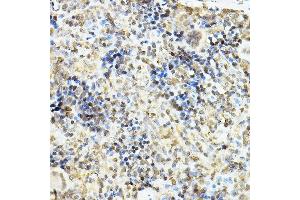 Immunohistochemistry of paraffin-embedded rat spleen using Glucocorticoid Receptor Rabbit pAb (ABIN3023090, ABIN3023091, ABIN3023092, ABIN1513281 and ABIN6219384) at dilution of 1:100 (40x lens).