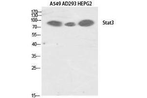 Western Blotting (WB) image for anti-Signal Transducer and Activator of Transcription 3 (Acute-Phase Response Factor) (STAT3) (Tyr1222) antibody (ABIN3187081) (STAT3 anticorps  (Tyr1222))
