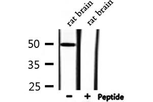 Western blot analysis of extracts from rat brain, using FOXD3 Antibody.