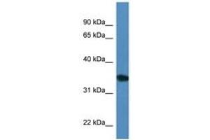 UPP2 anticorps  (AA 200-249)