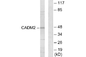 Western blot analysis of extracts from HepG2 cells, using CADM2 antibody. (CADM2 anticorps)