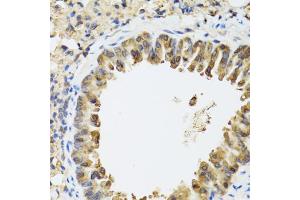 Immunohistochemistry of paraffin-embedded mouse lung using STAT3 antibody (ABIN1876697) at dilution of 1:100 (40x lens). (STAT3 anticorps)