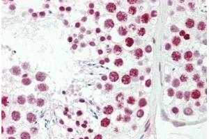 Human Testis: Formalin-Fixed, Paraffin-Embedded (FFPE) (FOXL1 anticorps  (AA 94-119))