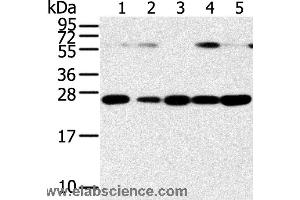 Western blot analysis of Human placenta tissue and hela cell, hepg2 cell and human fetal liver tissue, A549 cell and human normal kidney tissue, using SNAP23 Polyclonal Antibody at dilution of 1:400 (SNAP23 anticorps)