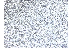 (ABIN185584) Negative Control showing staining of paraffin embedded Human Heart, with no primary antibody.