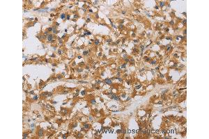 Immunohistochemistry of Human tonsil using RAD54L2 Polyclonal Antibody at dilution of 1:40 (ARIP4 anticorps)