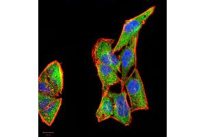 Immunofluorescence analysis of Hela cells using CSF3 mouse mAb (green).