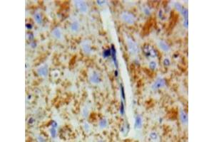 IHC-P analysis of Brain tissue, with DAB staining. (DVL2 anticorps  (AA 78-250))