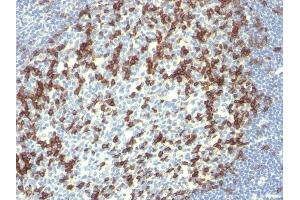 Formalin-fixed, paraffin-embedded human Tonsil stained with PD1 (CD279) Monoclonal Antibody (PDCD1/922). (PD-1 anticorps)