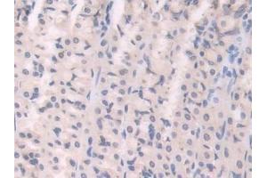 Detection of UCP1 in Rat Stomach Tissue using Polyclonal Antibody to Uncoupling Protein 1, Mitochondrial (UCP1)