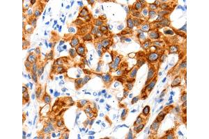 Immunohistochemistry (IHC) image for anti-Solute Carrier Family 2 (Facilitated Glucose Transporter), Member 11 (SLC2A11) antibody (ABIN2426005) (SLC2A11 anticorps)
