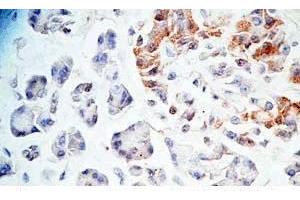 Human pancreas tissue was stained by Rabbit Anti-AdrenomeduIIiln-Gly (Human) Antibody (Adrenomedullin-Gly anticorps)