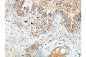 IHC analysis of formalin-fixed paraffin-embedded fetal lung, using TTC25 antibody (1/100 dilution). (TTC25 anticorps  (AA 47-236))