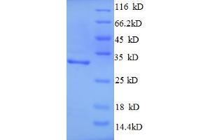 SDS-PAGE (SDS) image for Superoxide Dismutase 2, Mitochondrial (SOD2) (AA 1-25), (full length) protein (GST tag) (ABIN5710708)