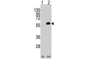 Western blot analysis of MEF2C (arrow) using rabbit MEF2C polyclonal antibody . (MEF2C anticorps  (Thr300))