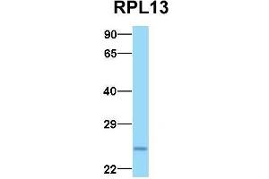 Host:  Rabbit  Target Name:  RPL13  Sample Type:  293T  Antibody Dilution:  1.