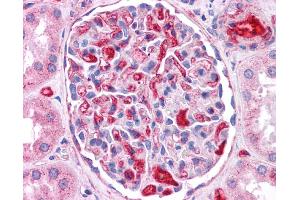 ApoE antibody was used for immunohistochemistry at a concentration of 4-8 ug/ml. (APOE anticorps  (N-Term))