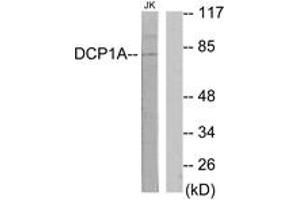 Western blot analysis of extracts from Jurkat cells, using DCP1A Antibody. (DCP1A anticorps  (AA 111-160))