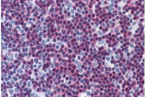 anti-Calcium/calmodulin-Dependent Protein Kinase IV (CAMK4) (AA 1-474) antibody