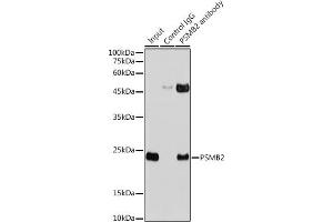 Immunoprecipitation analysis of 300 μg extracts of HeLa cells using 3 μg PSMB2 antibody (ABIN6129441, ABIN6146313, ABIN6146315 and ABIN6217703). (PSMB2 anticorps  (AA 1-201))